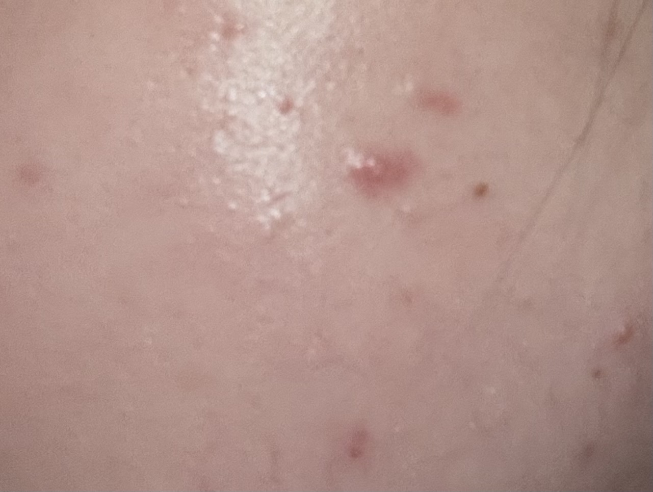 レビュー投稿画像